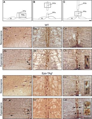 In Transgenic Erythropoietin Deficient Mice, an Increase in Respiratory Response to Hypercapnia Parallels Abnormal Distribution of CO2/H+-Activated Cells in the Medulla Oblongata